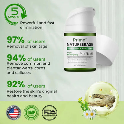 Zeooez NatureErase Instant Mole & Spot Cream