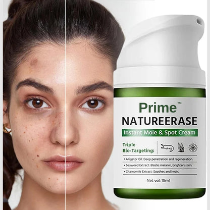 Zeooez NatureErase Instant Mole & Spot Cream