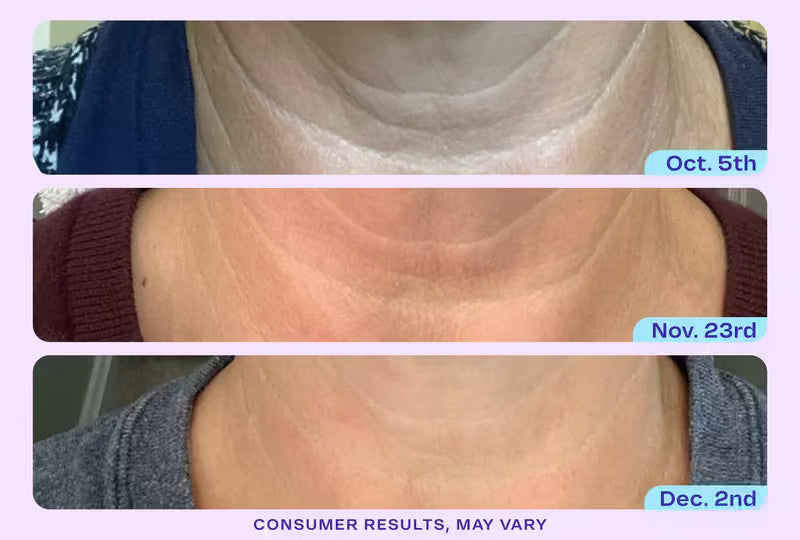 Zeooez Tighten & Lift Neck Cream