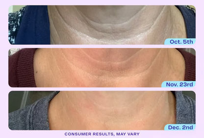 Zeooez Tighten & Lift Neck Cream