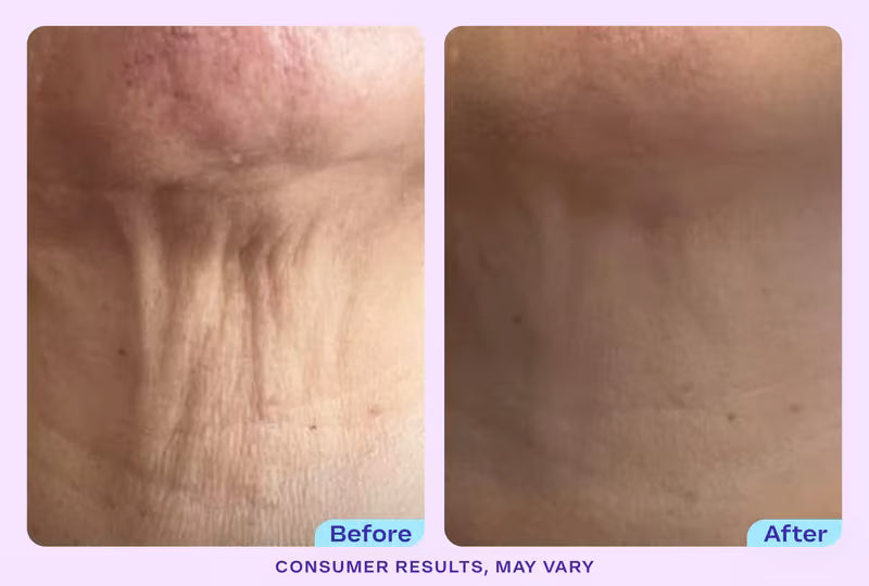 Zeooez Tighten & Lift Neck Cream