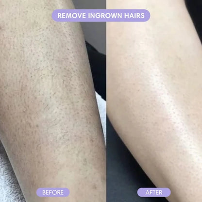 Zeooez Bikini Pain-Free Hair Removal Cream for Sensitive Skin