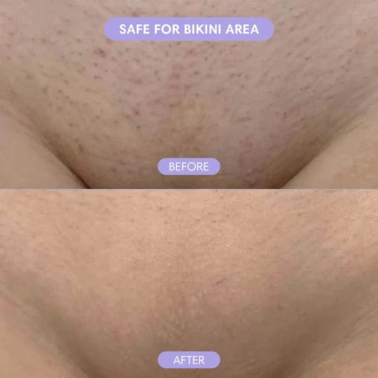 Zeooez Bikini Pain-Free Hair Removal Cream for Sensitive Skin