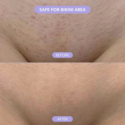 Zeooez Bikini Pain-Free Hair Removal Cream for Sensitive Skin